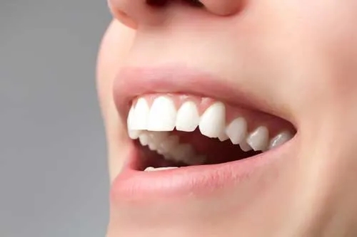 راه های حفظ دندان های سالم نکات و راهکارهای مراقبت از دندان